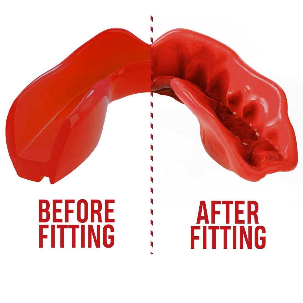 SAFEJAWZ Mouthguard Slim Fit, Adults and Junior Mouth Guard with Case for Boxing, Basketball, Lacrosse, Football, Mma, Martial Arts, Hockey and All - Image 3